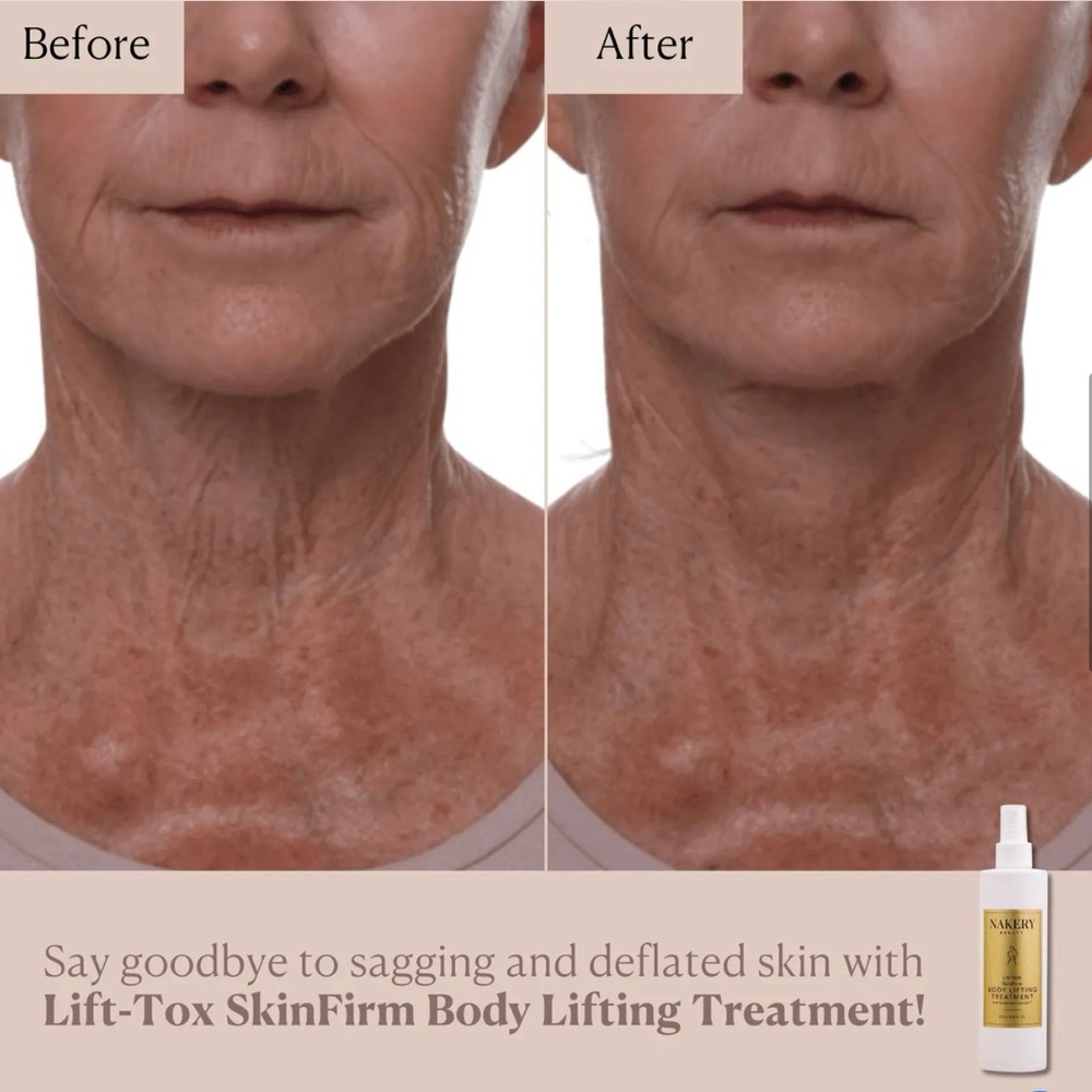 $44 retail Nakery Beauty Body Lift-TOX SkinFirm Treatment - Picture 3 of 7